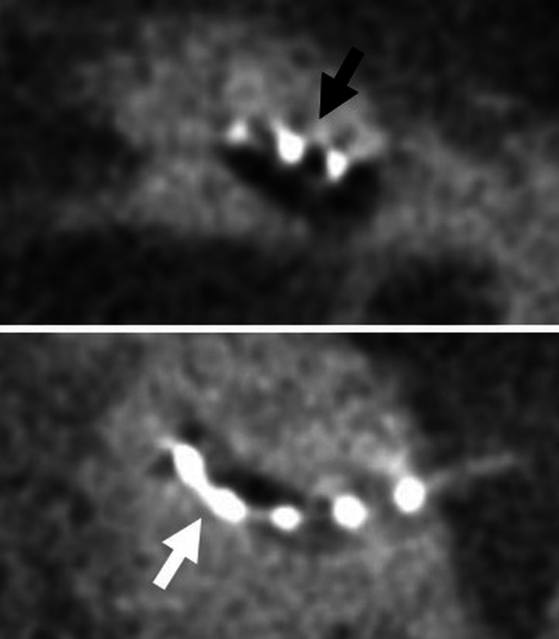 Fig. 25