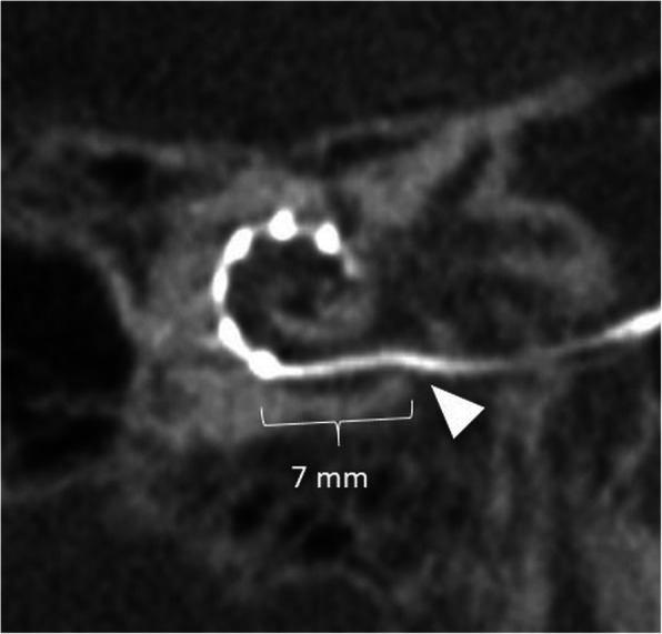 Fig. 26