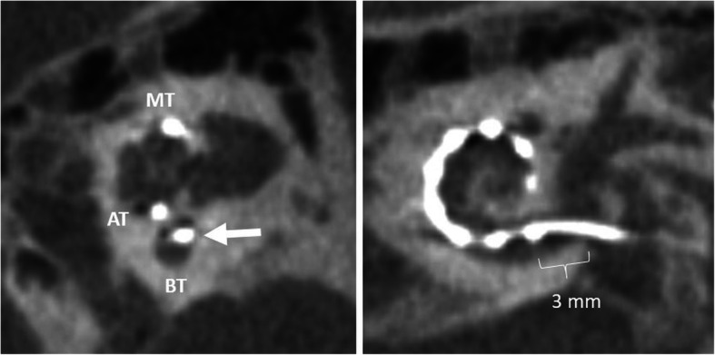 Fig. 20