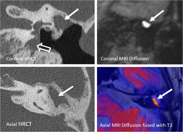 Fig. 17