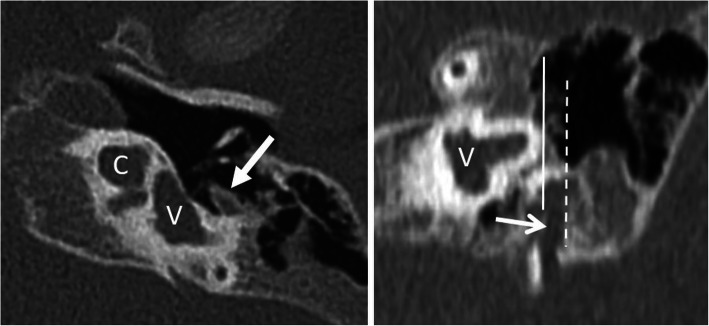 Fig. 12