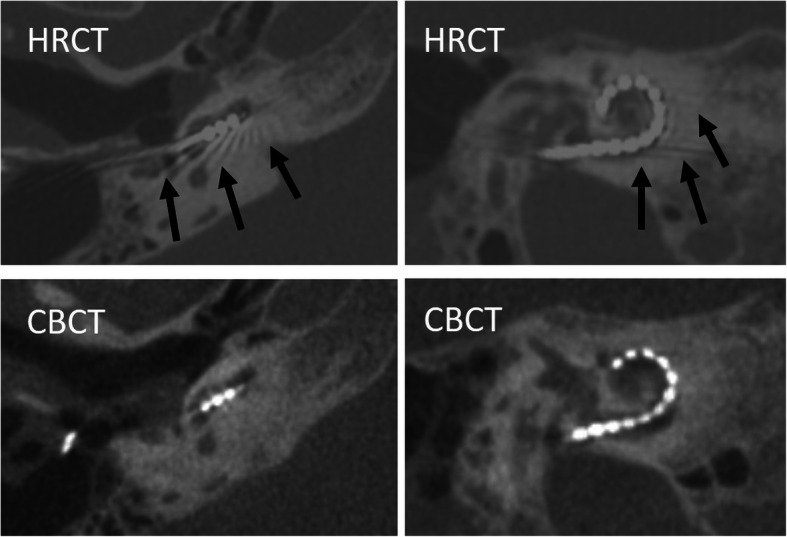 Fig. 18