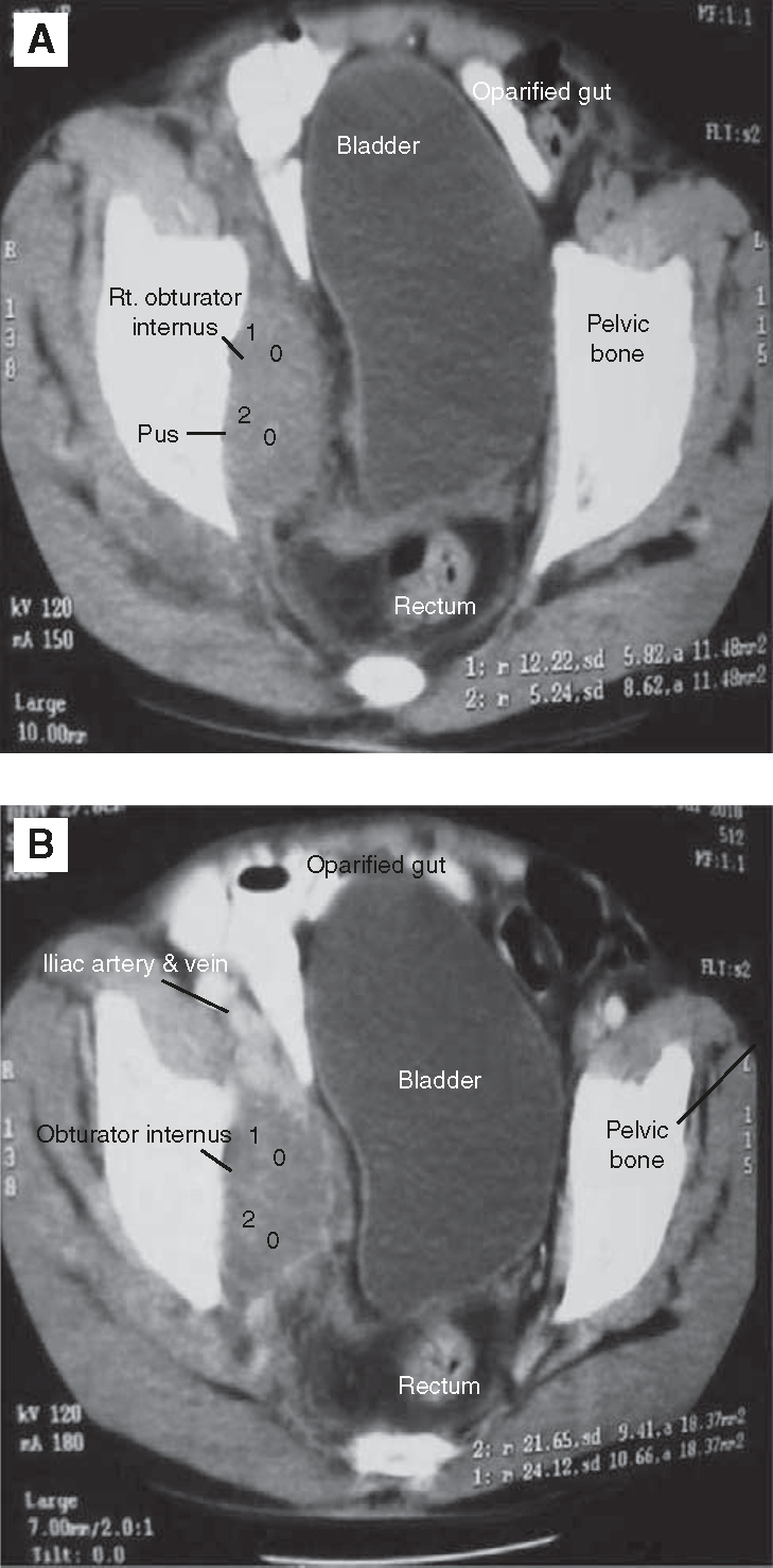 Figure 1(A, B)
