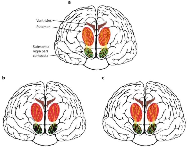 Fig. (1)