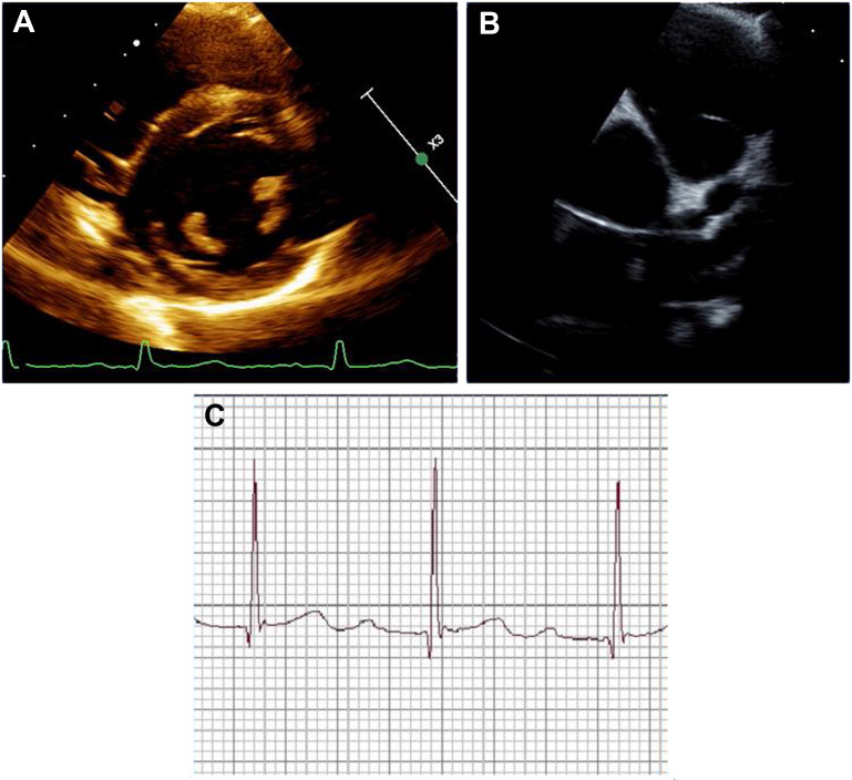 Fig. 2