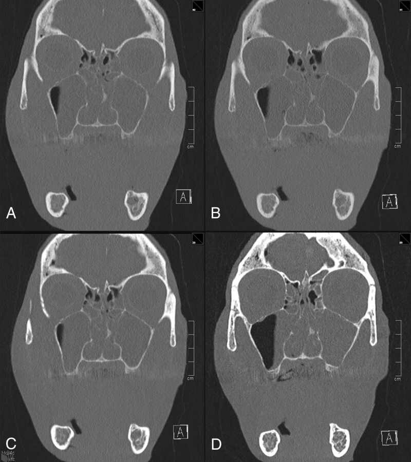 Fig 2.