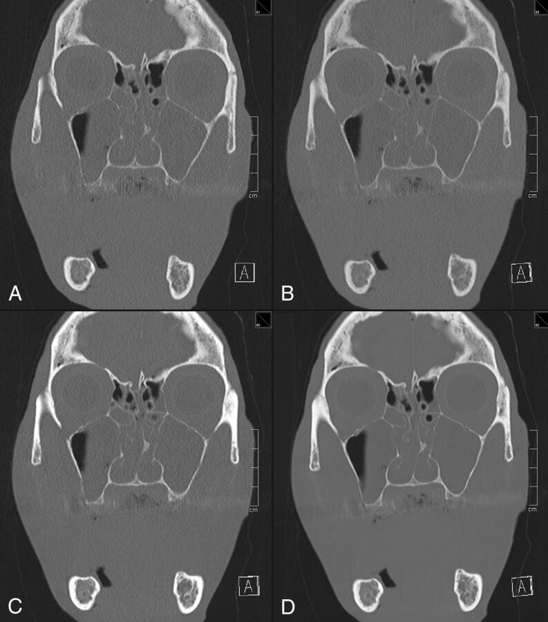 Fig 1.