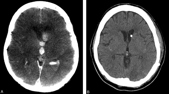 Fig 2.