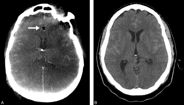 Fig 3.