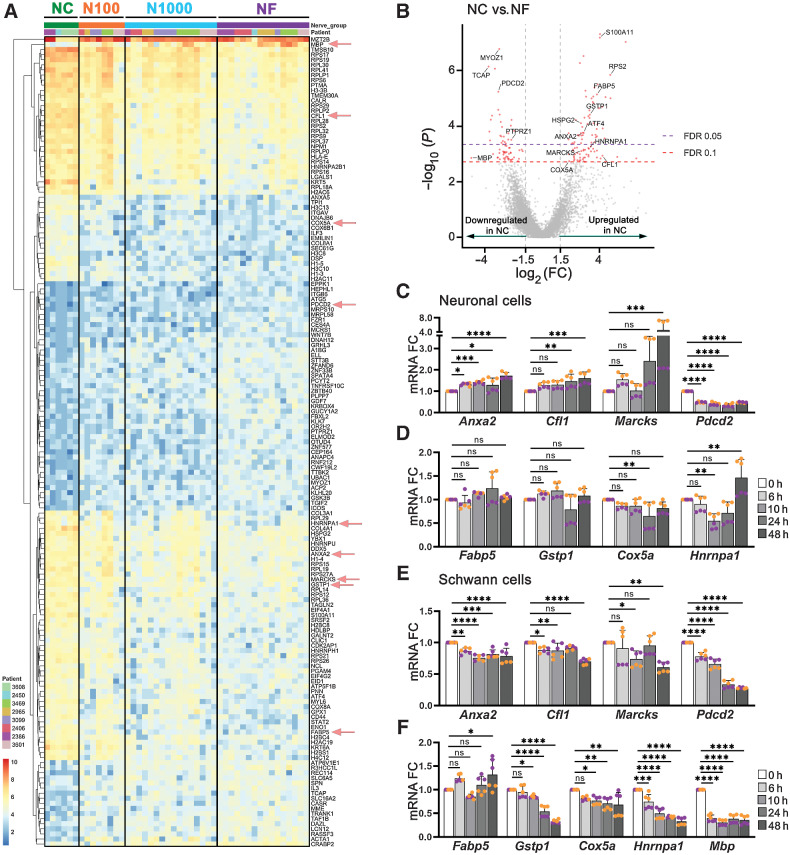 Figure 6. DEGs in nerves close to and far from tumor. A, Heatmap of 46 AOIs across 8 patients, showing 159 significant (FDR ≤ 0.1) differentially expressed genes in NC versus NF. Each row of the heatmap represents the z-score transformed log2 values of one DEG across all samples (blue, low expression; red, high expression). AOI types are identified on top. Genes selected for in vitro validation (C–F) are highlighted with red arrows. B, Volcano plot of differentially expressed genes, identified in red. FDR ≤ 0.05 and ≤ 0.10 are identified by dashed lines. C and D, 50B11 neuronal cells were treated with conditioned medium from cancer cells (UM-SCC-29) for up to 48 hours and mRNA expression of selected genes was assessed. E and F, S16 Schwann cells were treated as described in C and D. Each color represents an independent experiment in C, D, E, and F. Timepoints are depicted in shades of gray. (One-way ANOVA P values: * < 0.05; ** < 0.01; *** < 0.001; **** < 0.0001).