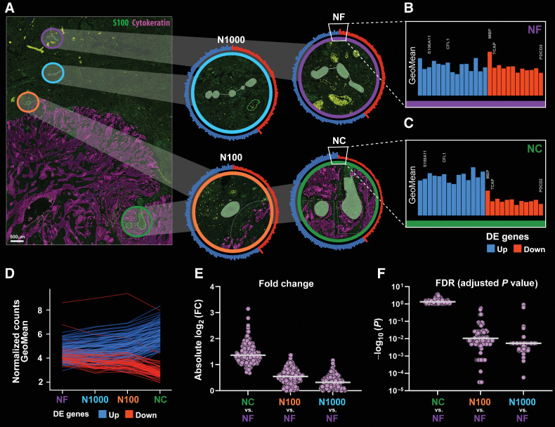 Figure 5. Transcriptomic profile of nerves varies with nerve-tumor distance. A, Biopsy sections were stained with morphology markers (cytokeratin in purple and S100 in green) for identification of AOIs. AOIs are overlaid in the fluorescence image and enlarged in panels at right: NC (within 100 μm from tumor with at least 50% surrounded by tumor cells) is identified in green, N100 (within 100 μm from tumor cells but excluded from NC) in orange, N1000 (nerve between 100 and 1,000 μm from tumor) in light blue and NF (beyond 1,000 μm from tumor) in purple. Circular bar graphs around each enlarged AOI represent log2-transformed normalized gene counts (GeoMeans) of 159 genes that were differentially expressed between NC and NF. Blue bars are upregulated and red bars are downregulated in NC. Enlarged GeoMean bar graphs of NF (B) and NC (C) show differences in gene expression. D, GeoMeans for 159 genes as a function of the type of AOI. Upregulated genes go gradually up whereas downregulated genes go gradually down from NF to NC. Gradual differences are observed for the log2(FC; E) and adjusted P values (FDR; F) for 159 genes as a function of nerve-tumor distance. NC versus NF has the largest log2(FC) and the smallest FDR values, while N1000 versus NF are most similar in terms of gene expression. Scale bar (A), 500 μm.