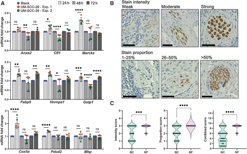 Figure 7. Validation of DEGs in nerves close to cancer. A, DRG from rat were cocultured for the designated timepoints in the presence or absence of UM-SCC-29 cells; mRNA expression of selected genes was measured. Timepoints are depicted in shades of gray. (One-way ANOVA P values: * < 0.05; ** < 0.01; *** < 0.001; **** < 0.0001). B and C, IHC for MBP; nerves close to (NC, n = 35) and far from tumor (NF, n = 40) were scored for intensity and proportion of stain, and a combined score (intensity × proportion) was generated. Scale bars = 50 μm; n = 8 patients. Quantification is shown in C (Mann–Whitney test P values: *** < 0.001; **** < 0.0001).