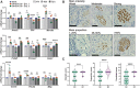 Figure 7. Validation of DEGs in nerves close to cancer. A, DRG from rat were cocultured for the designated timepoints in the presence or absence of UM-SCC-29 cells; mRNA expression of selected genes was measured. Timepoints are depicted in shades of gray. (One-way ANOVA P values: * < 0.05; ** < 0.01; *** < 0.001; **** < 0.0001). B and C, IHC for MBP; nerves close to (NC, n = 35) and far from tumor (NF, n = 40) were scored for intensity and proportion of stain, and a combined score (intensity × proportion) was generated. Scale bars = 50 μm; n = 8 patients. Quantification is shown in C (Mann–Whitney test P values: *** < 0.001; **** < 0.0001).