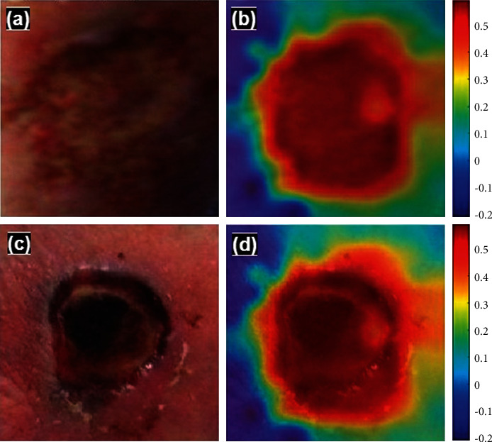 Figure 13