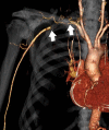 Figure 21