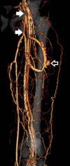 Figure 22