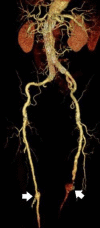 Figure 23