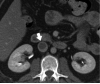 Figure 24