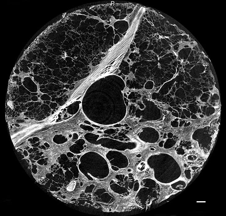 Figure 9b: