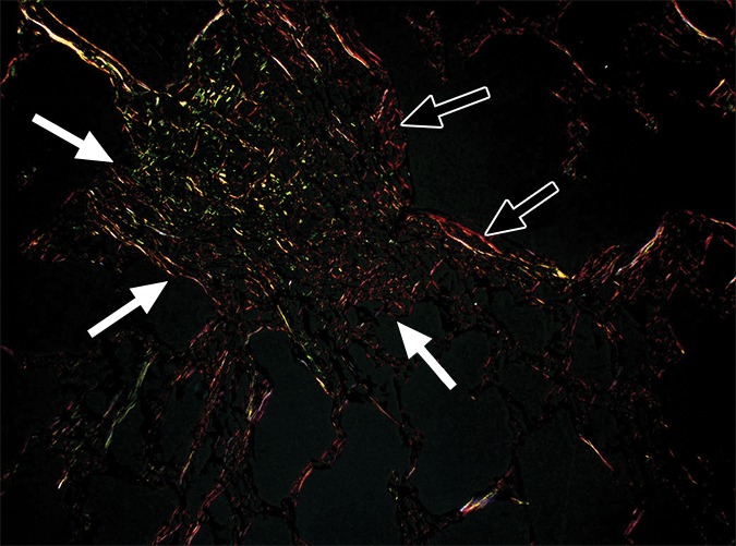 Figure 2e: