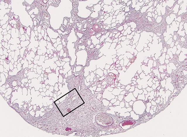 Figure 11b: