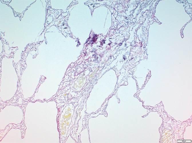 Figure 4e: