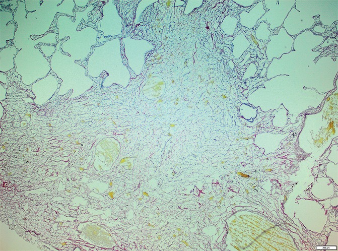 Figure 11c: