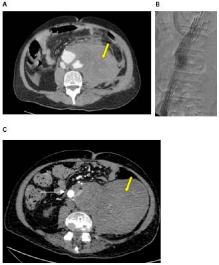 Fig. (2)