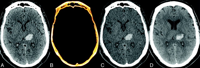 Fig 2.