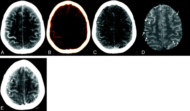 Fig 5.