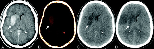 Fig 1.