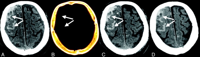 Fig 4.