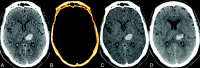 Fig 2.