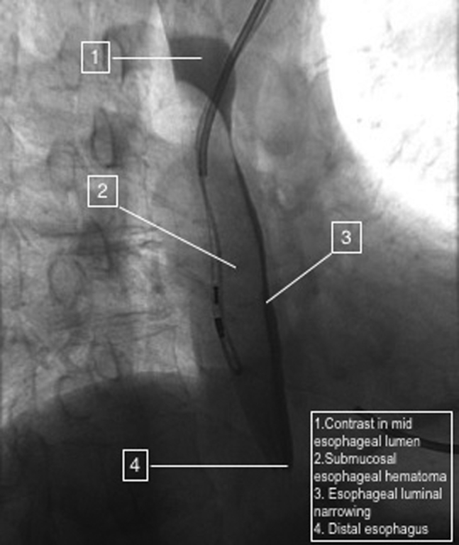 Fig. 3