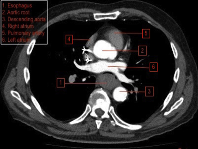 Fig. 1