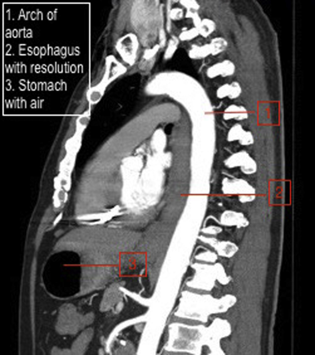 Fig. 4