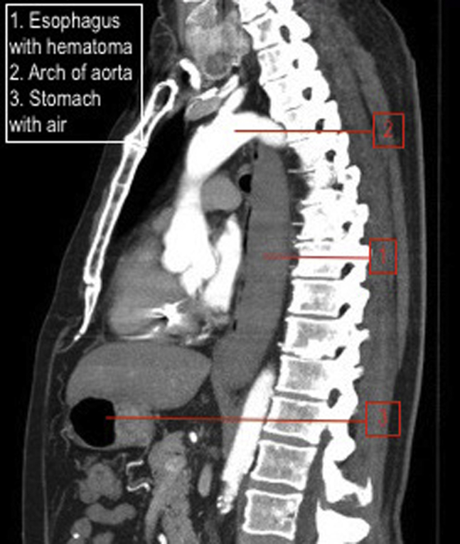 Fig. 2