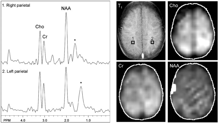 Fig 3.