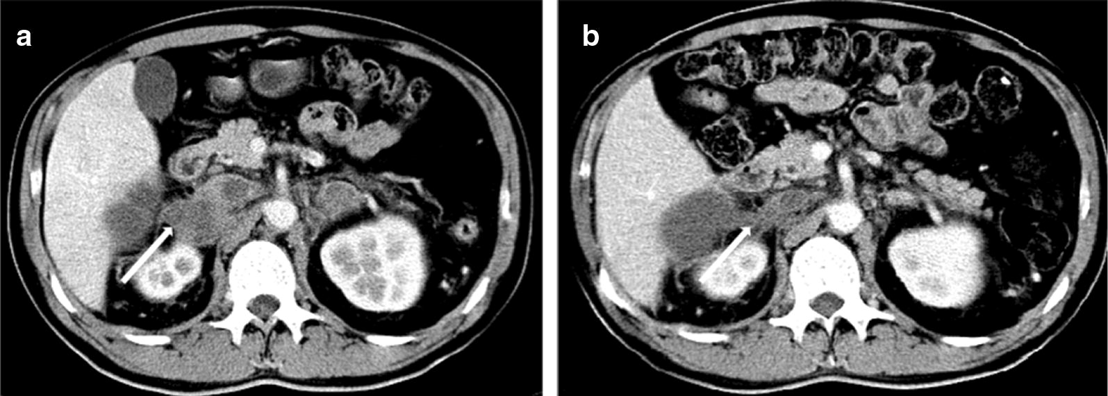 Fig. 1