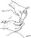 Fig. 2