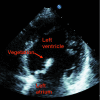 Fig 4