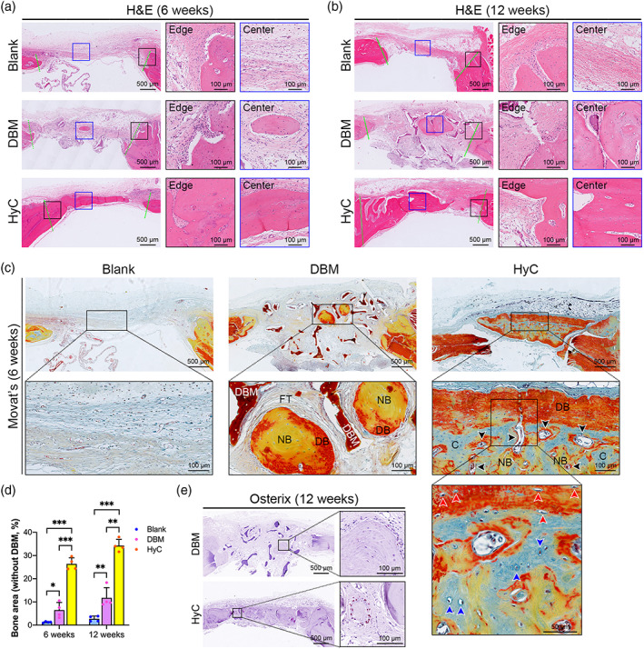 Engineering hypertrophic cartilage grafts from lipoaspirate for ...