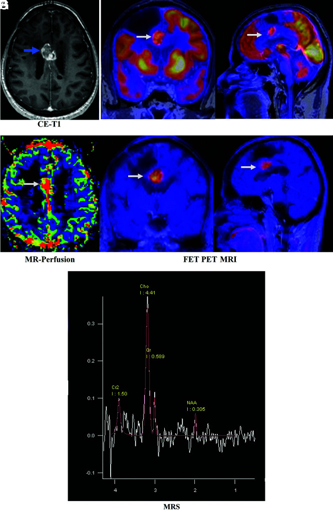 FIG 6.