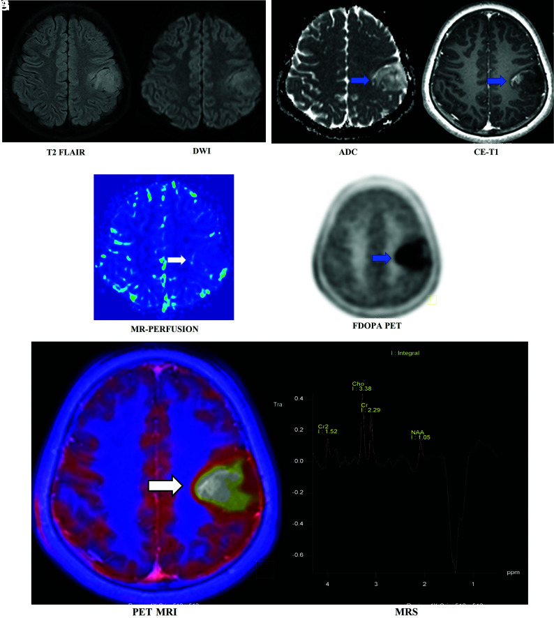 FIG 2.