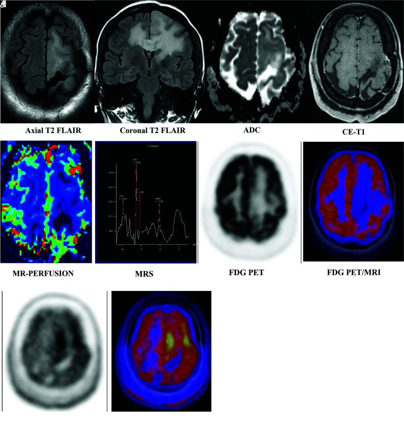 FIG 4.