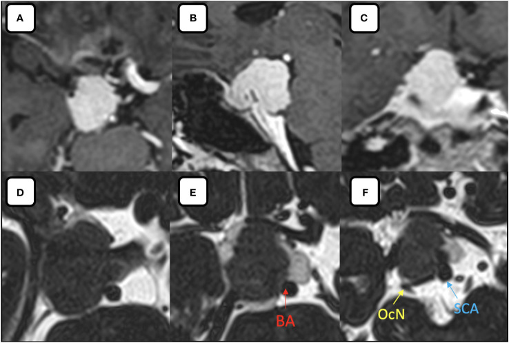 Figure 1