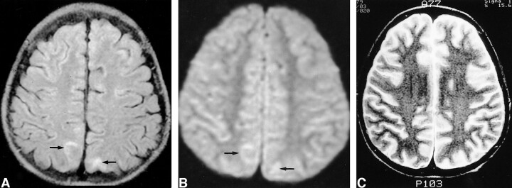 fig 2.