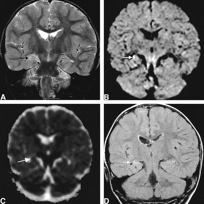 fig 3.