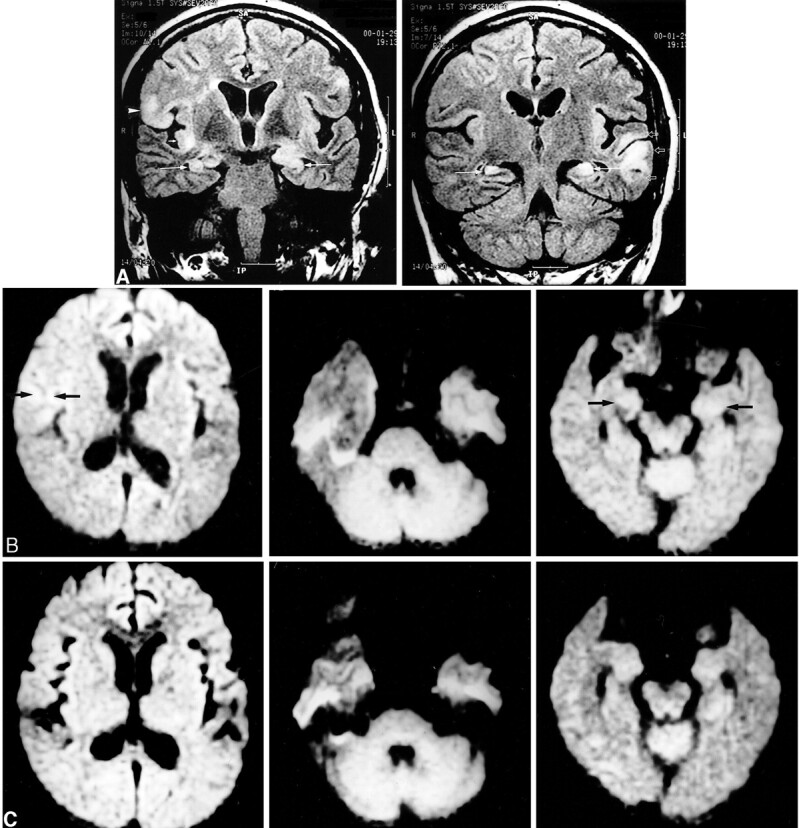 fig 5.