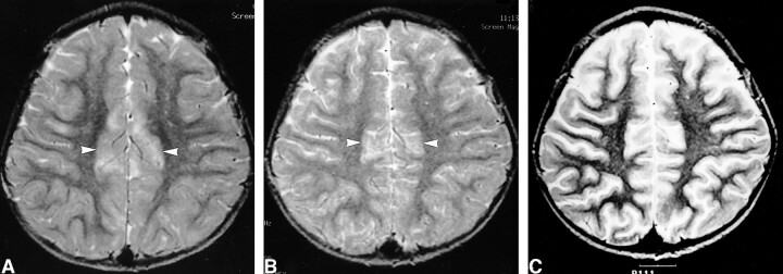 fig 6.